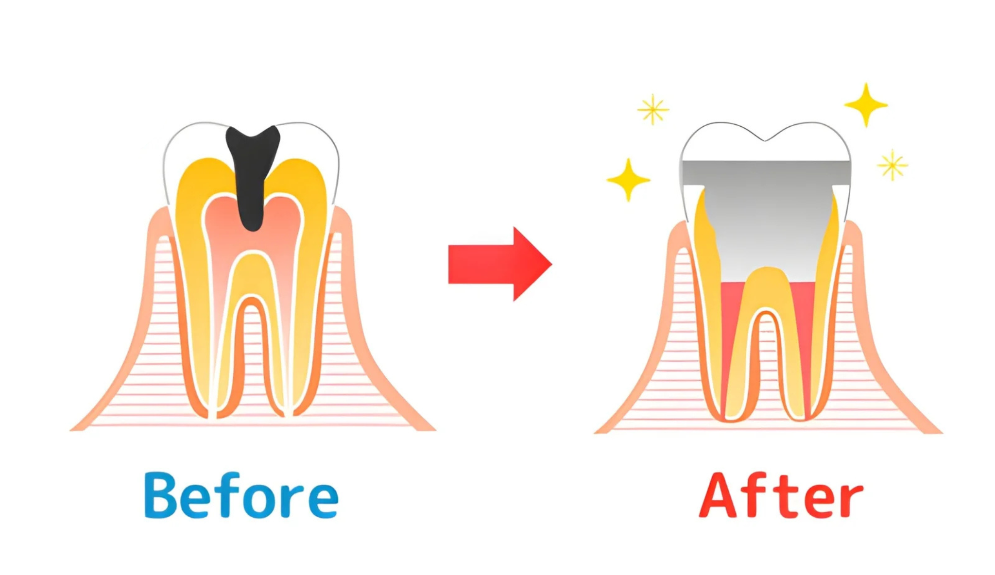 pediatric dental treatments