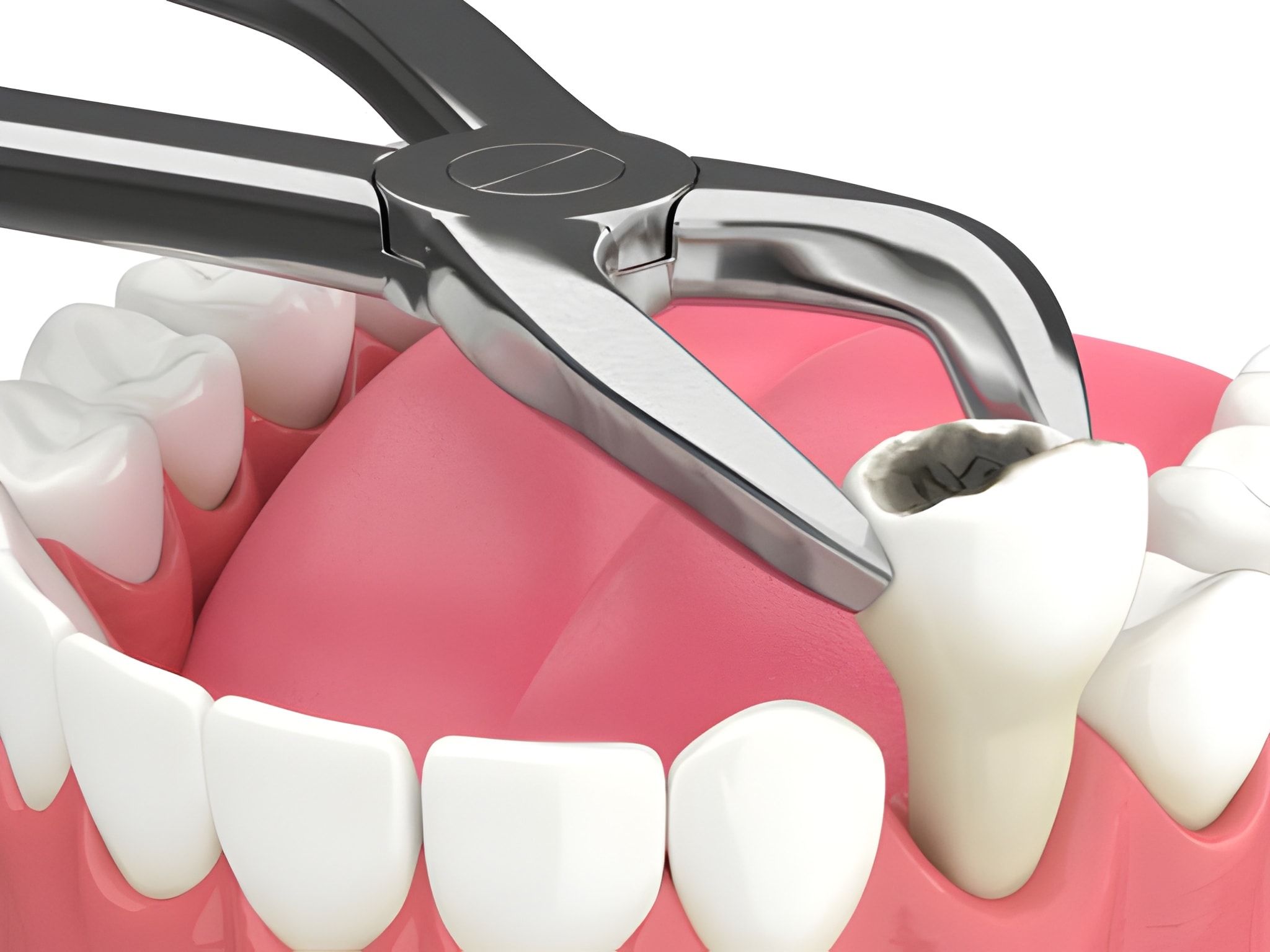 emergency kids dentist, emergency pediatric dental care